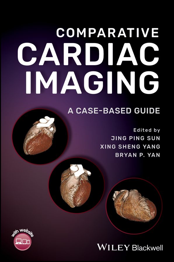 Picture of Comparative Cardiac Imaging