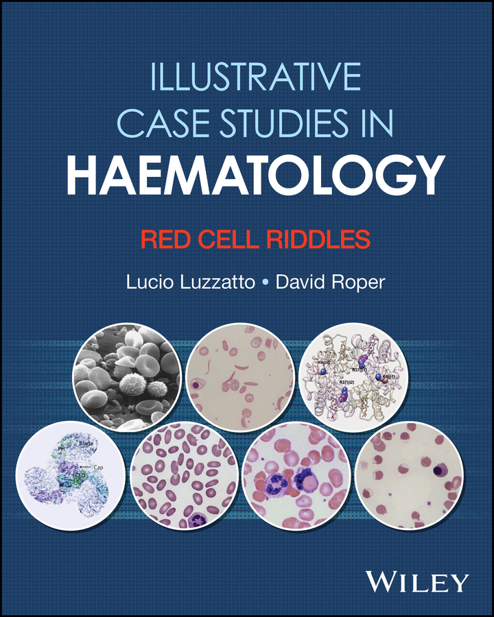 Essential Guide to Blood Coagulation, 2nd Edition | Wiley