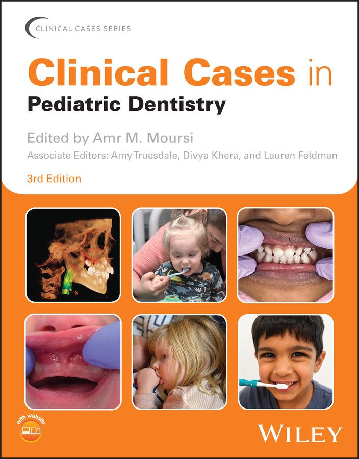 Dental Caries: The Disease and its Clinical Management, 4th