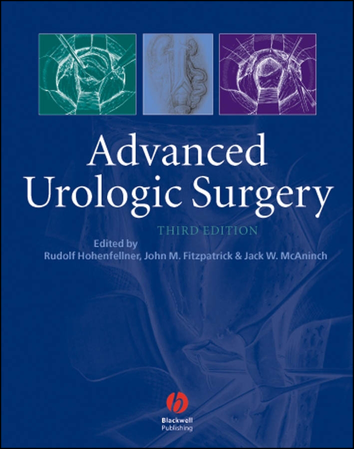 Advanced Urologic Surgery, 3rd Edition | Wiley