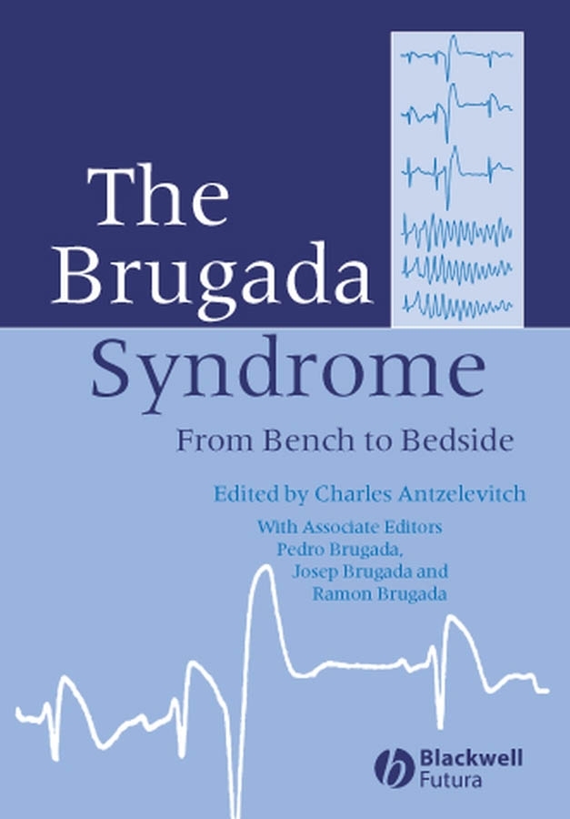 Picture of The Brugada Syndrome