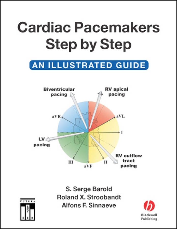 Cardiac Pacemakers and Resynchronization Step by Step: An