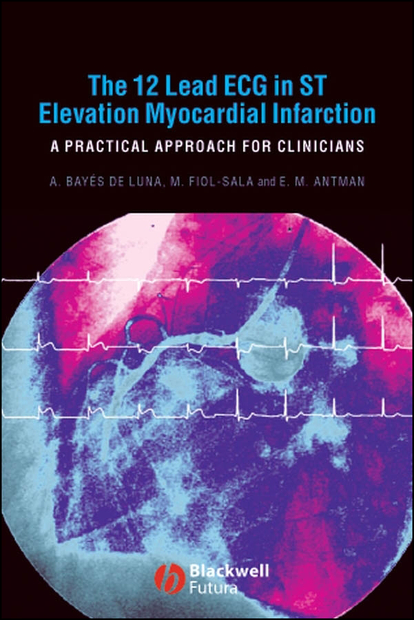 Clinical Electrocardiography: A Textbook, 5th Edition | Wiley