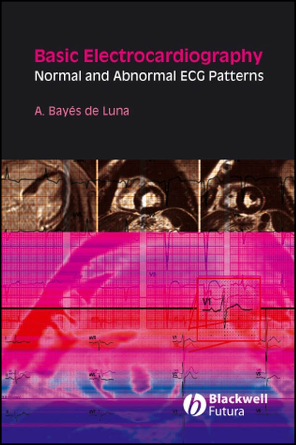 Clinical Electrocardiography: A Textbook, 5th Edition | Wiley